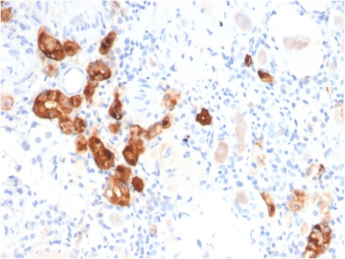 Anti-Calbindin Antibody [CALB1/2782] - BSA and Azide free