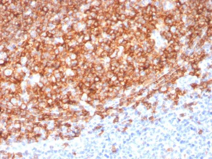 Anti-CD20 Antibody [MS4A1/3410] - BSA and Azide free