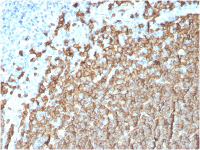 Anti-CD20 Antibody [MS4A1/3411] - BSA and Azide free