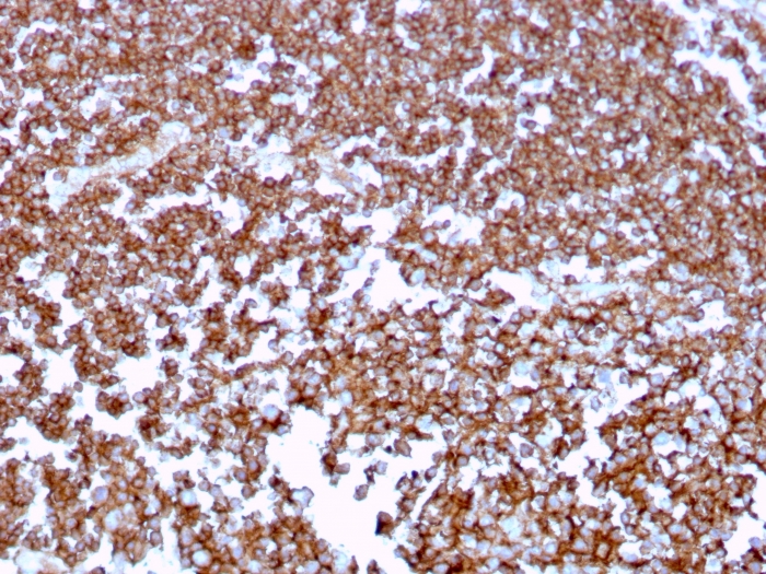 Anti-CD20 Antibody [MS4A1/3409] - BSA and Azide free