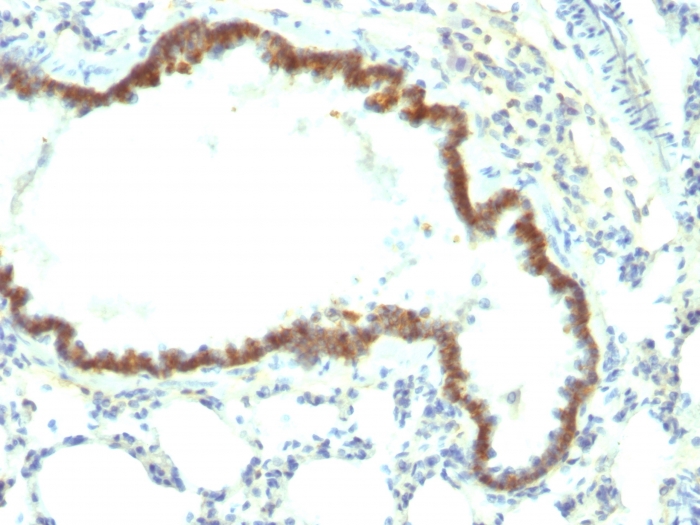 Anti-EpCAM Antibody [Epcam/1158]