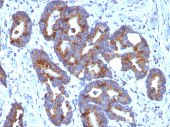 Anti-Blood Group Antigen A Antibody [HE-10] - BSA and Azide free