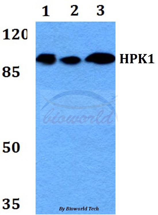 Anti-HPK1 (L397) Antibody