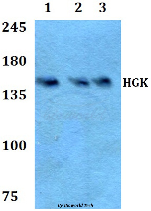 Anti-HGK (R430) Antibody