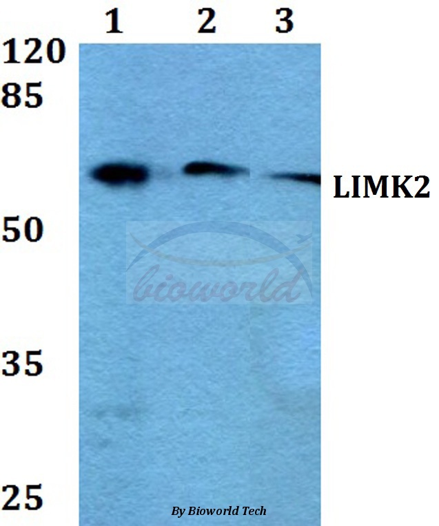 Anti-LIMK2 (K491) Antibody