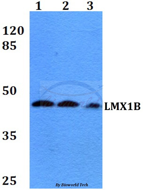 Anti-LMX1B (D159) Antibody