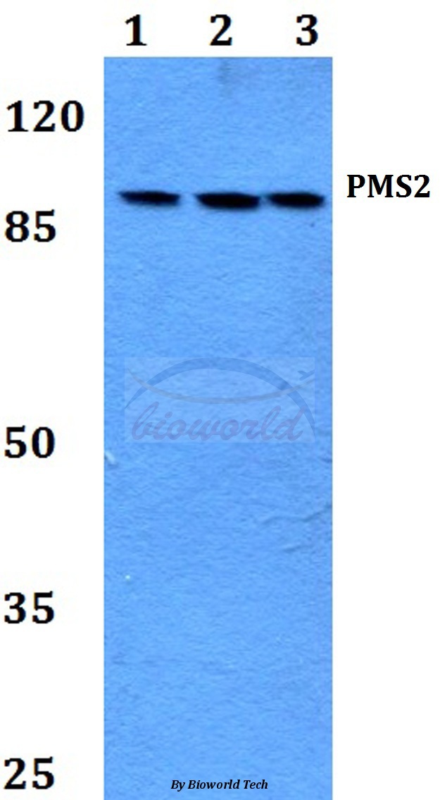 Anti-PMS2 (D483) Antibody