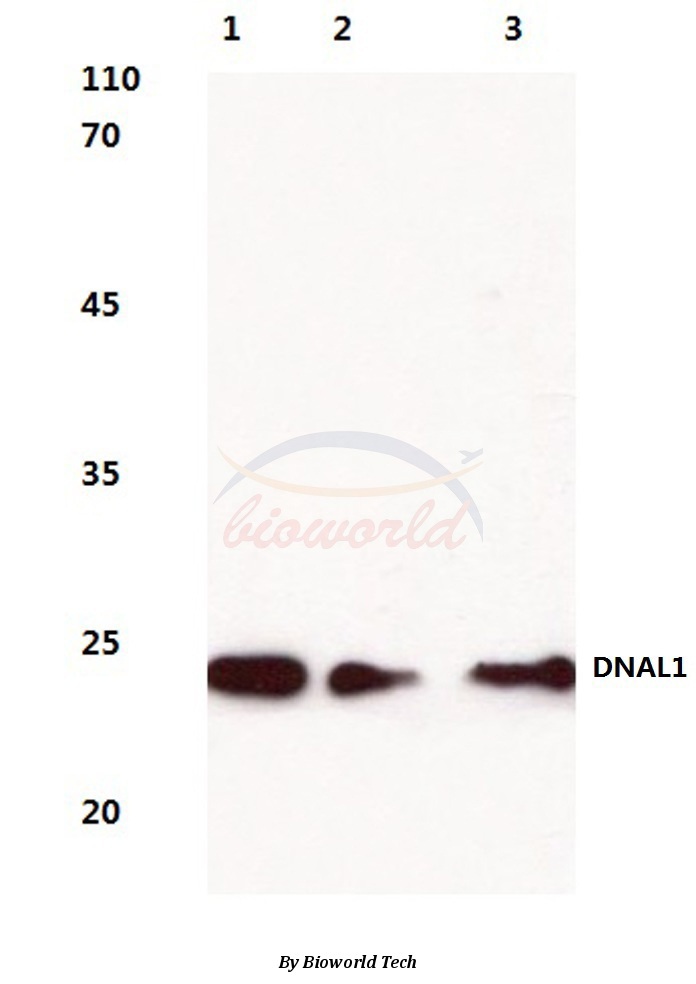 Anti-DNAL1 (N161) Antibody