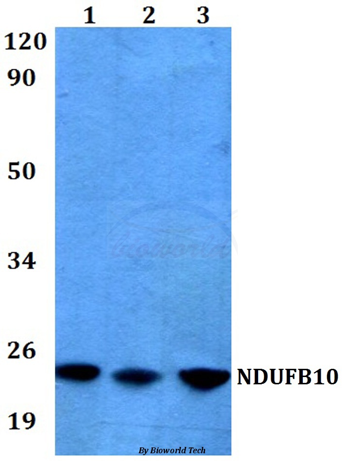 Anti-NDUFB10 (E95) Antibody