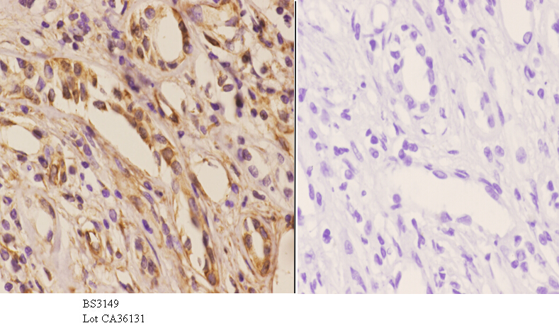 Anti-NXF3 (N104) Antibody