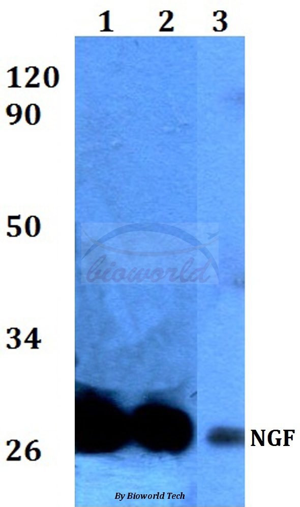 Anti-Pro-NGF (L82) Antibody