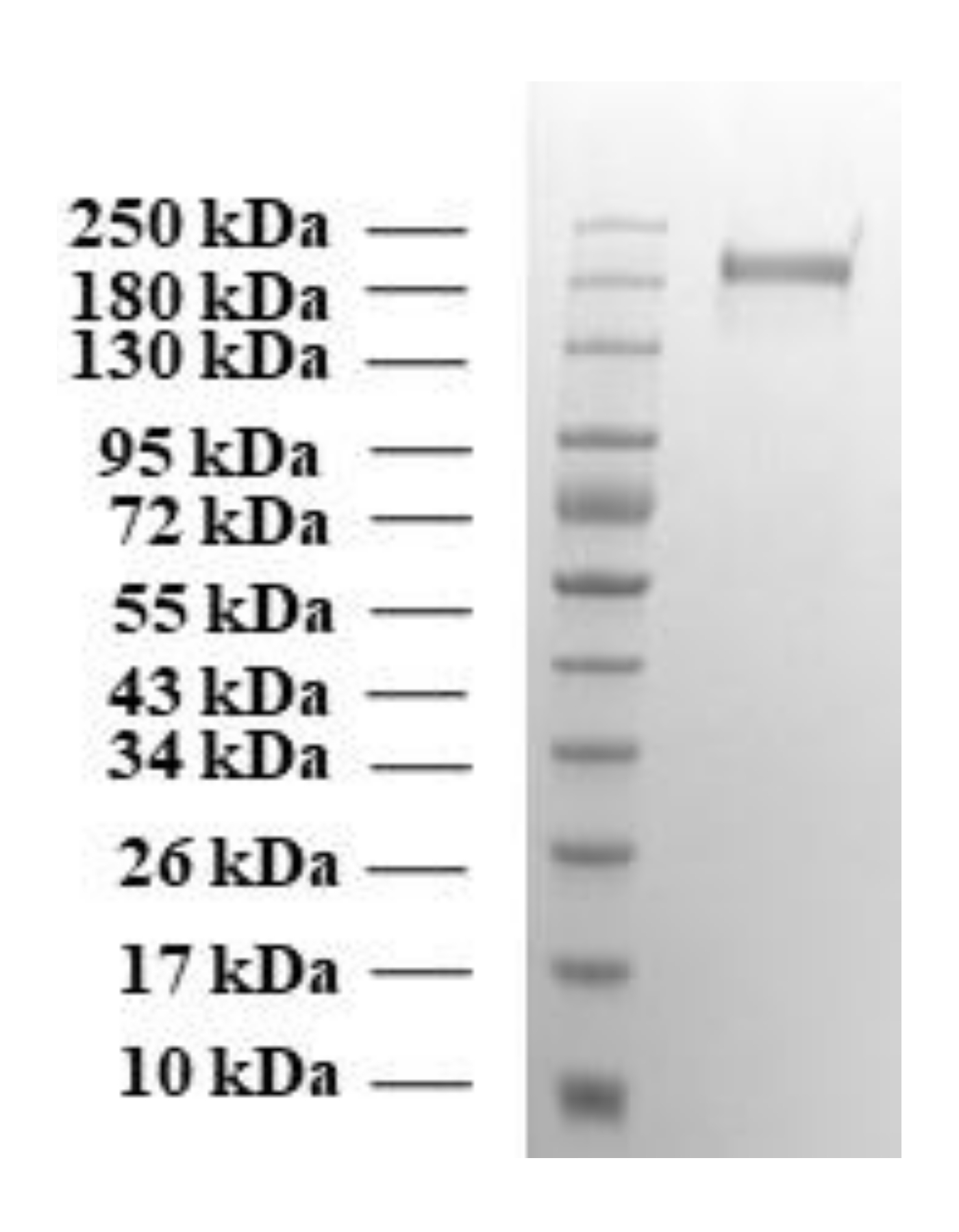 Recombinant SARS-CoV-2 Spike Protein (P.1. Variant) (Functional)