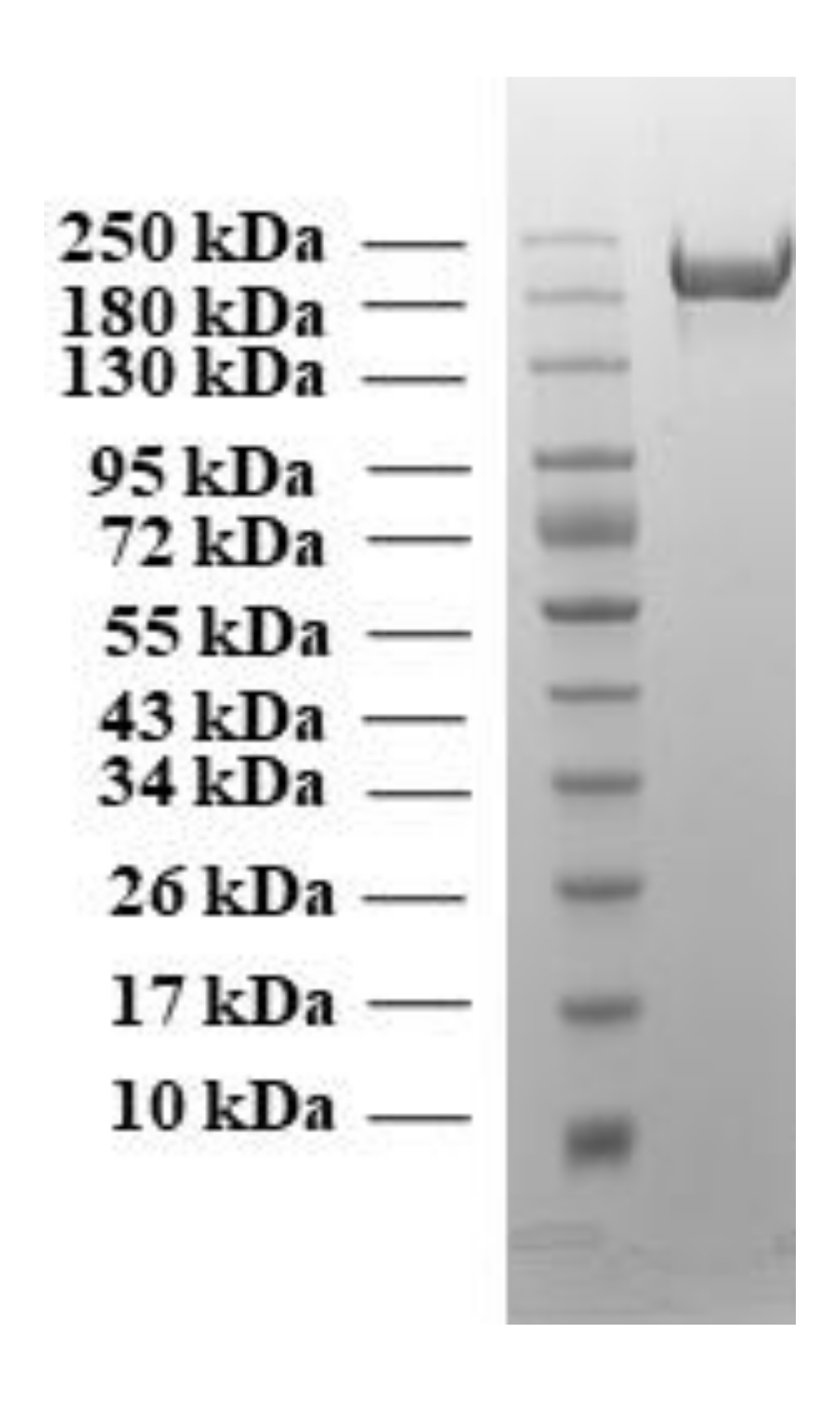 Recombinant SARS-CoV-2 Spike Protein (B.1.617 Variant) (Functional)