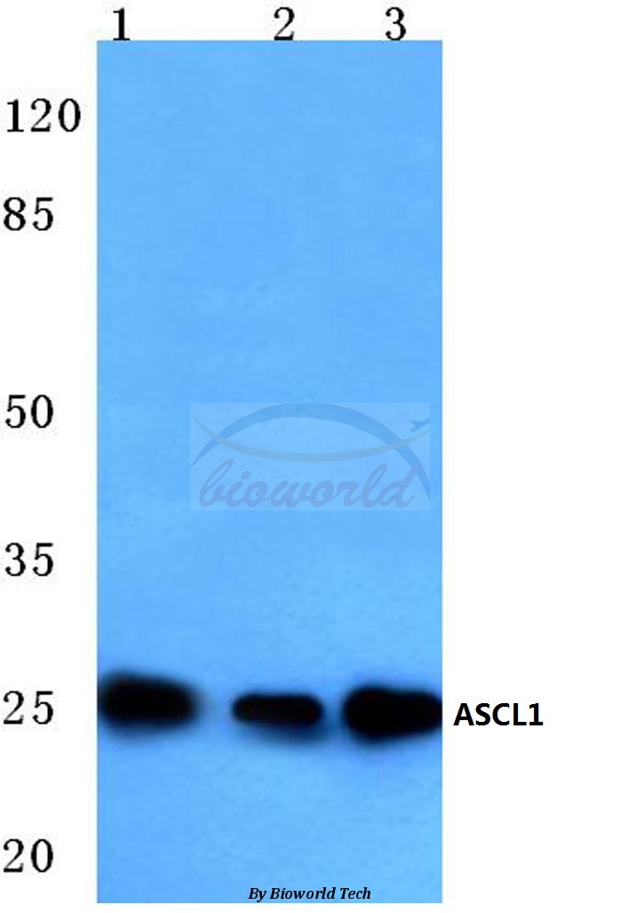 Anti-ASCL1 (E158) Antibody