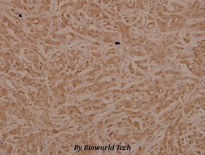 Anti-Tak1 (D181) Antibody