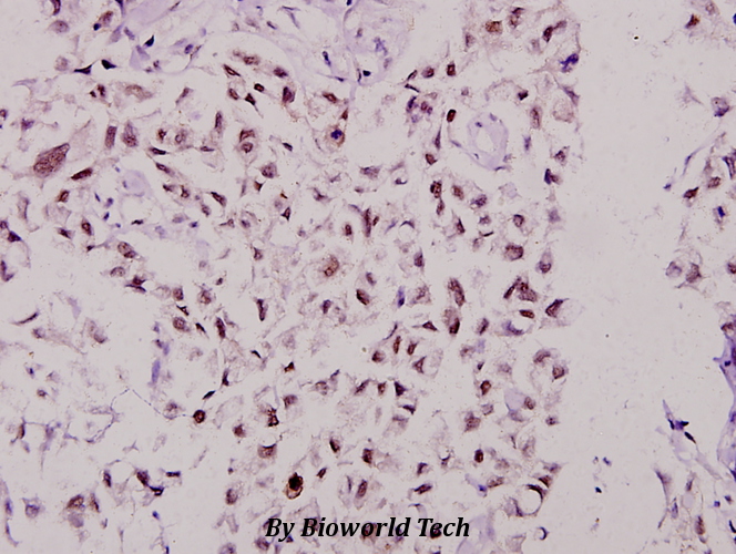 Anti-MSK1 (D205) Antibody