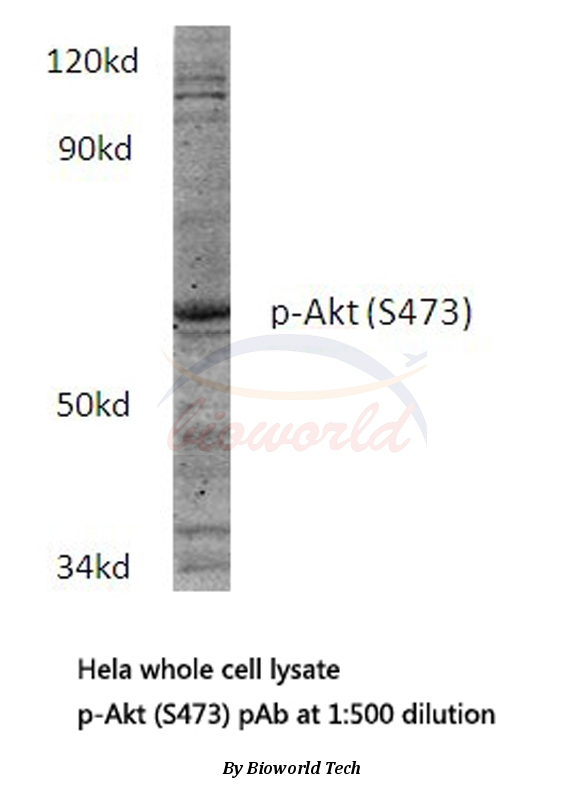 Anti-AKT (phospho-S473) Antibody