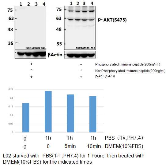 Anti-AKT (phospho-S473) Antibody