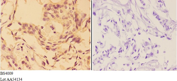 Anti-AKT (phospho-T308) Antibody