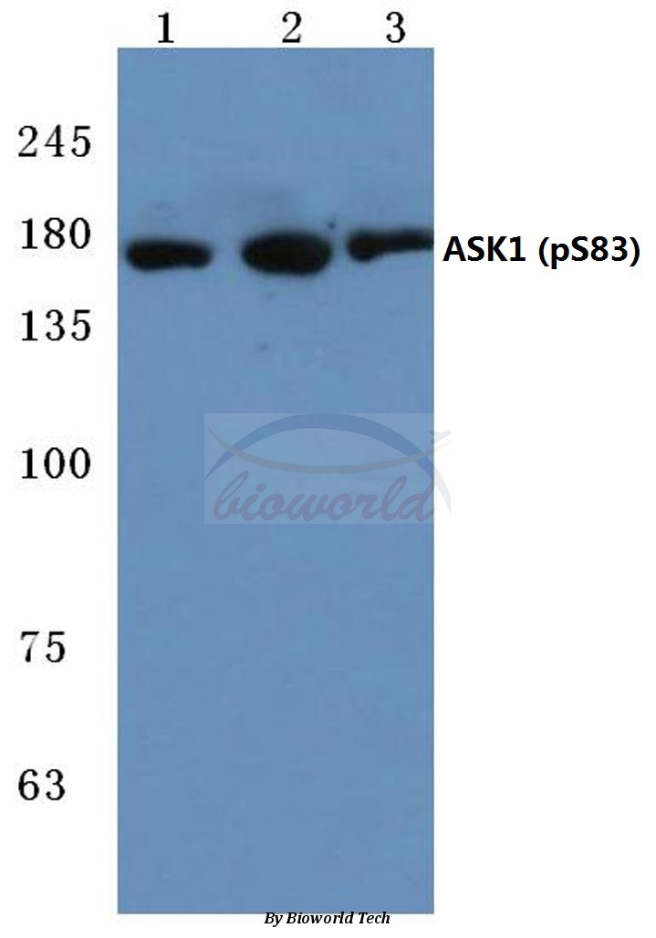 Anti-ASK1 (phospho-S83) Antibody