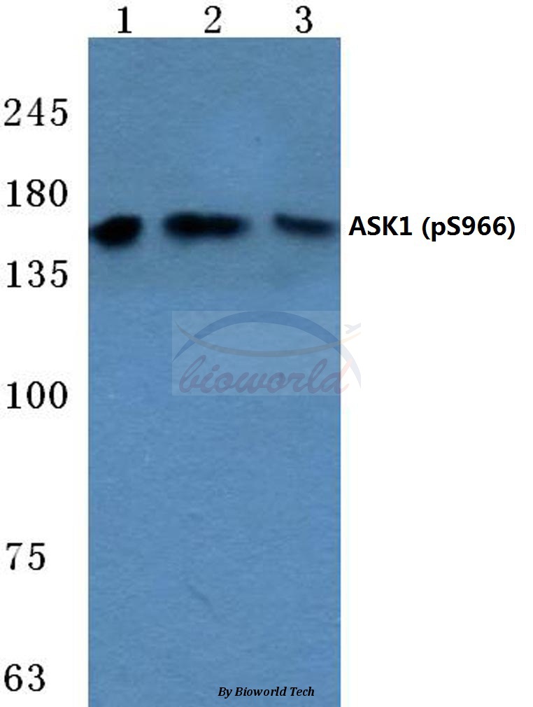 Anti-ASK1 (phospho-S966) Antibody