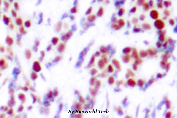 Anti-ATF2 (phospho-S112) Antibody