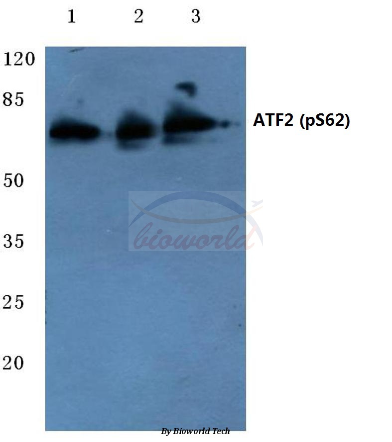 Anti-ATF2 (phospho-S62) Antibody