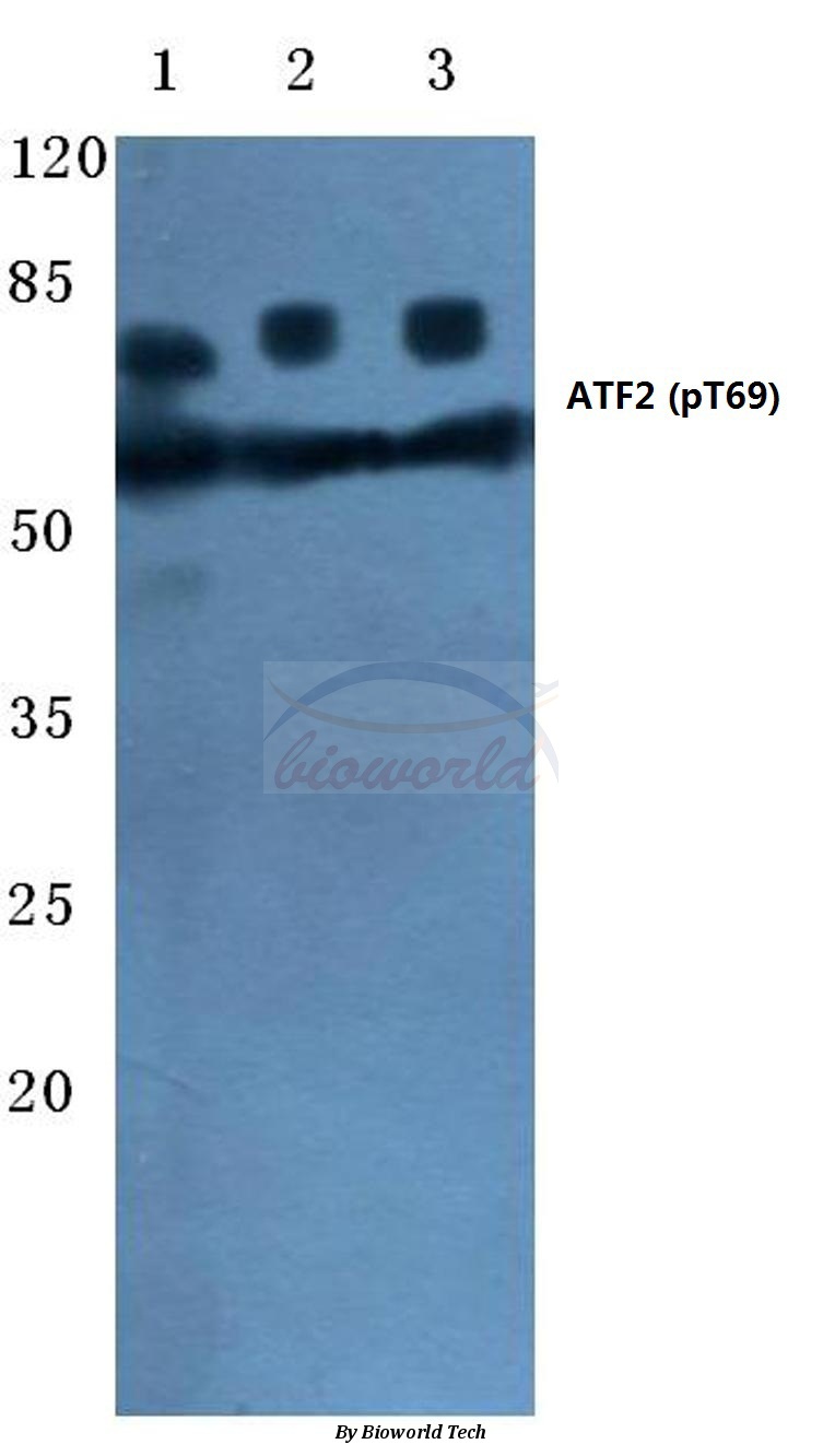 Anti-ATF2 (phospho-T69) Antibody