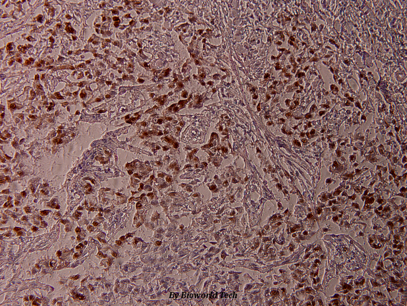 Anti-ATF2 (phospho-T71) Antibody