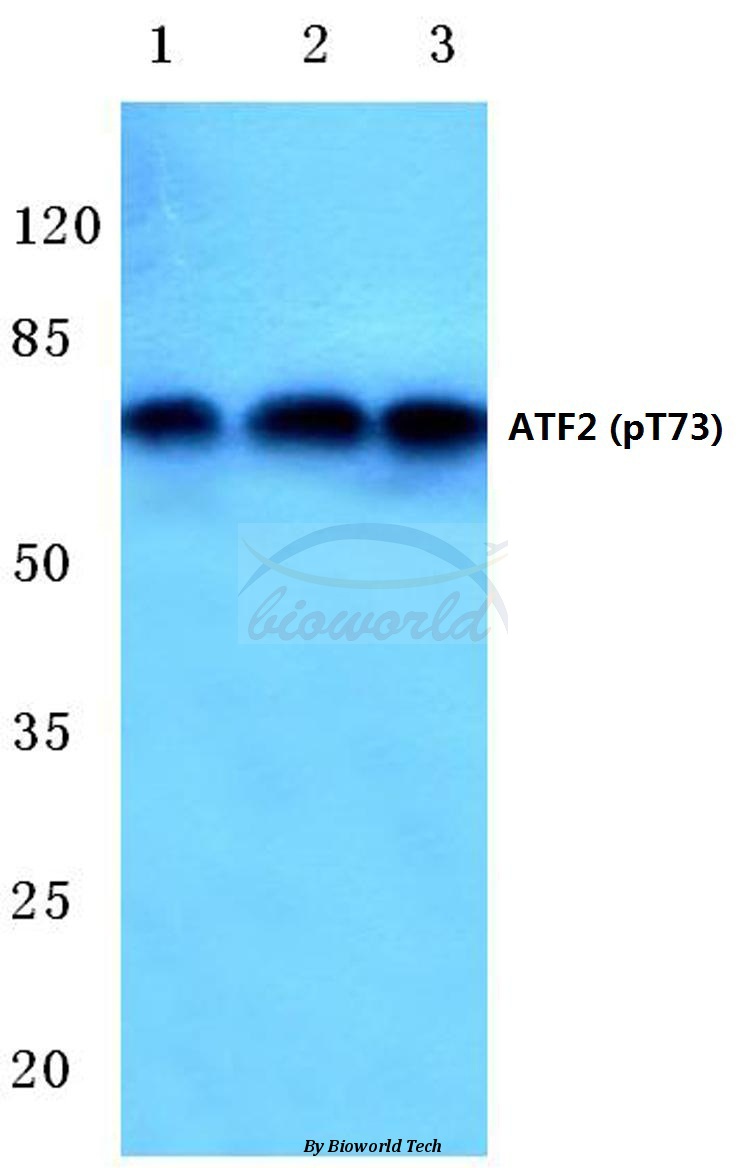 Anti-ATF2 (phospho-T73) Antibody