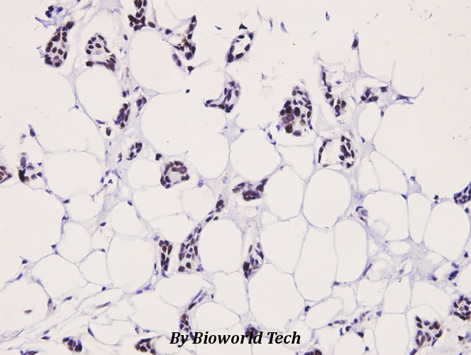 Anti-LIMK2 (phospho-T505) Antibody