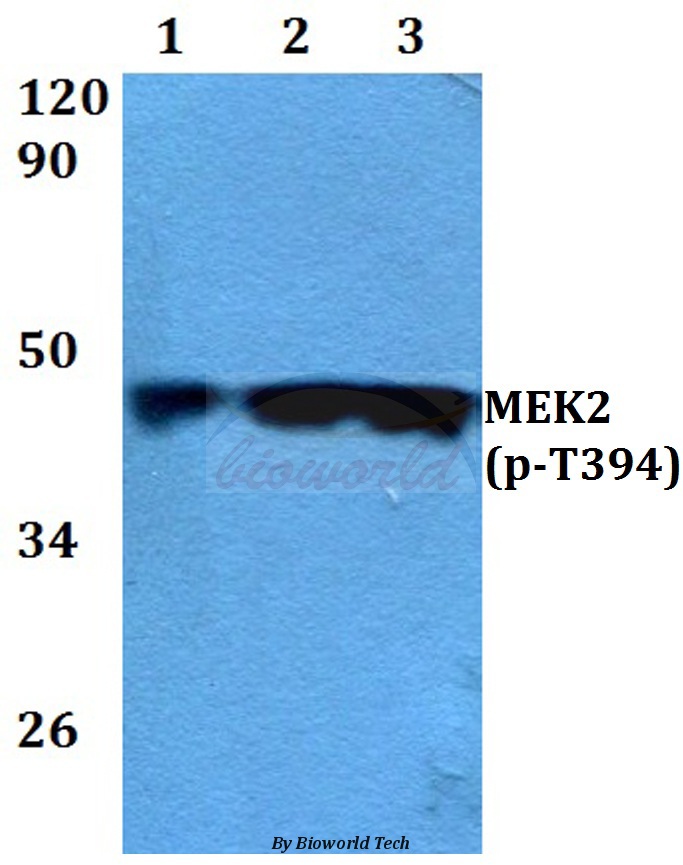 Anti-MEK2 (phospho-T394) Antibody