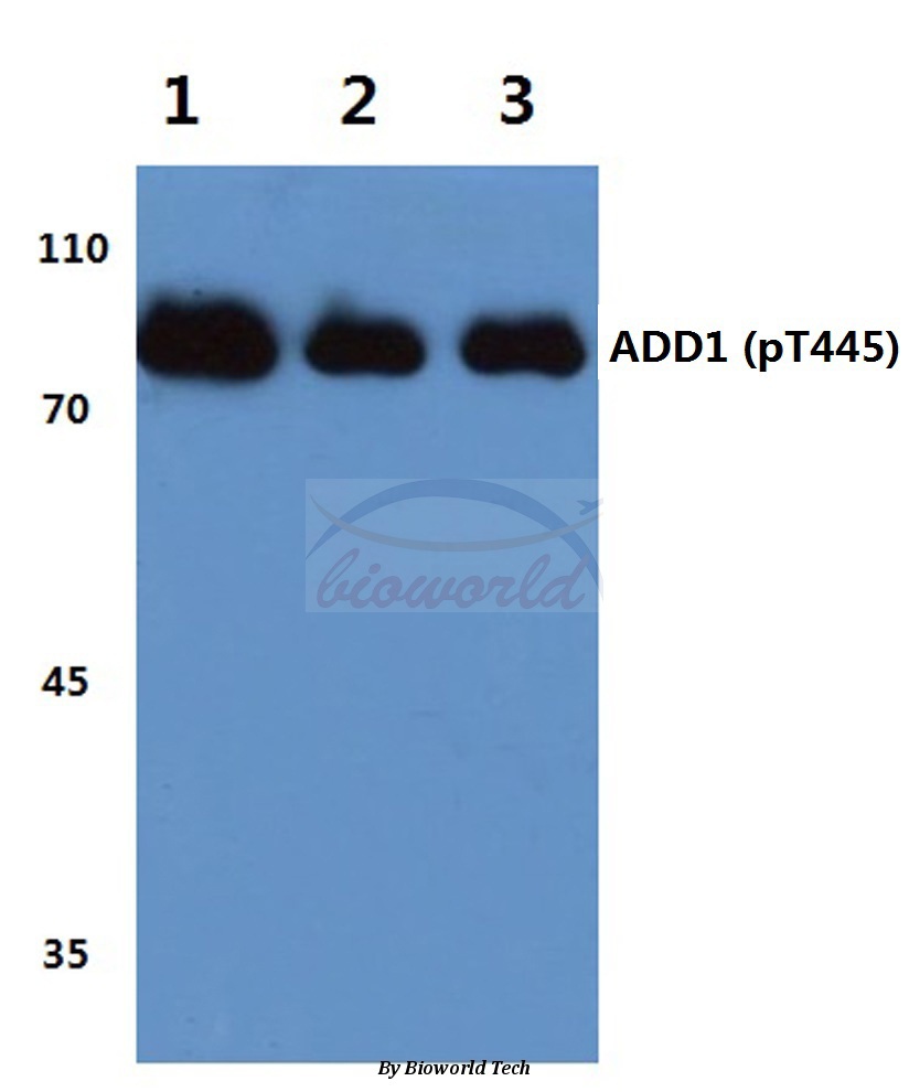 Anti-Adducin alpha (phospho-T445) Antibody