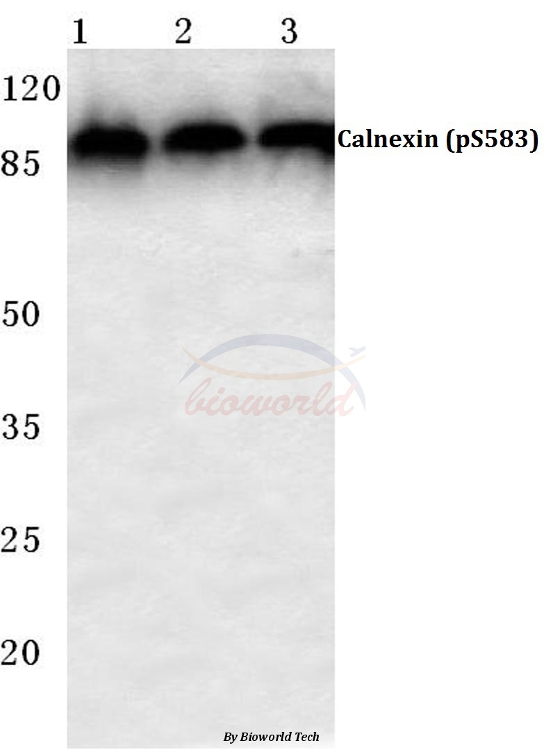 Anti-Calnexin (phospho-S583) Antibody