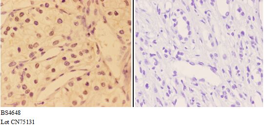 Anti-AKT (phospho-Y315) Antibody