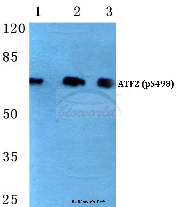 Anti-ATF2 (phospho-S498) Antibody