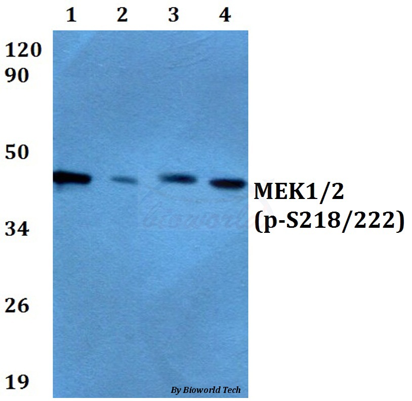 Anti-MEK1/2 (phospho-S218/222) Antibody