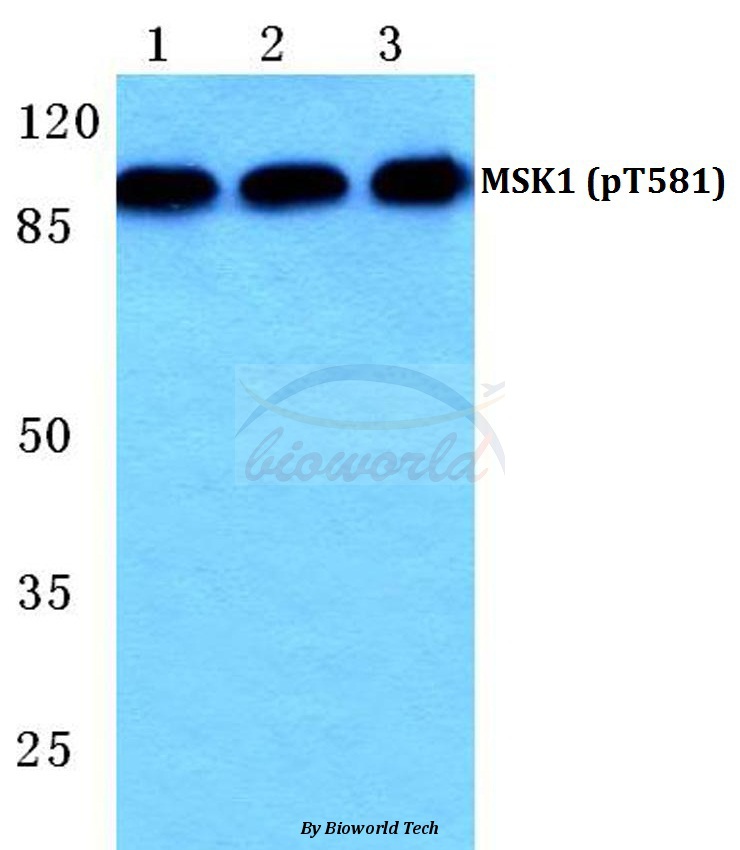 Anti-MSK1 (phospho-T581) Antibody