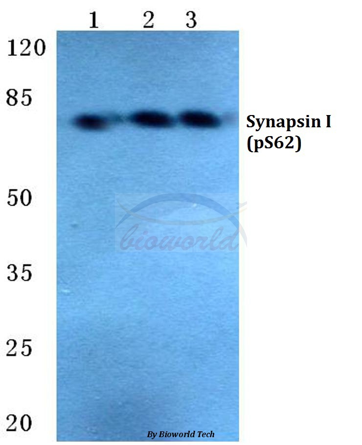 Anti-Synapsin I (phospho-S62) Antibody