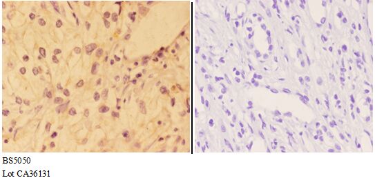 Anti-AKT (phospho-Y326) Antibody