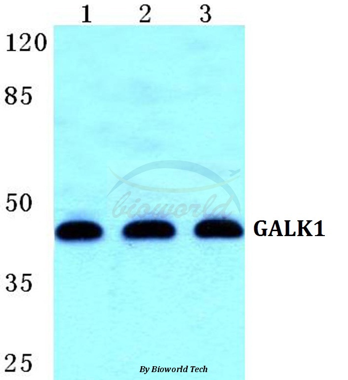 Anti-GALK1 Antibody