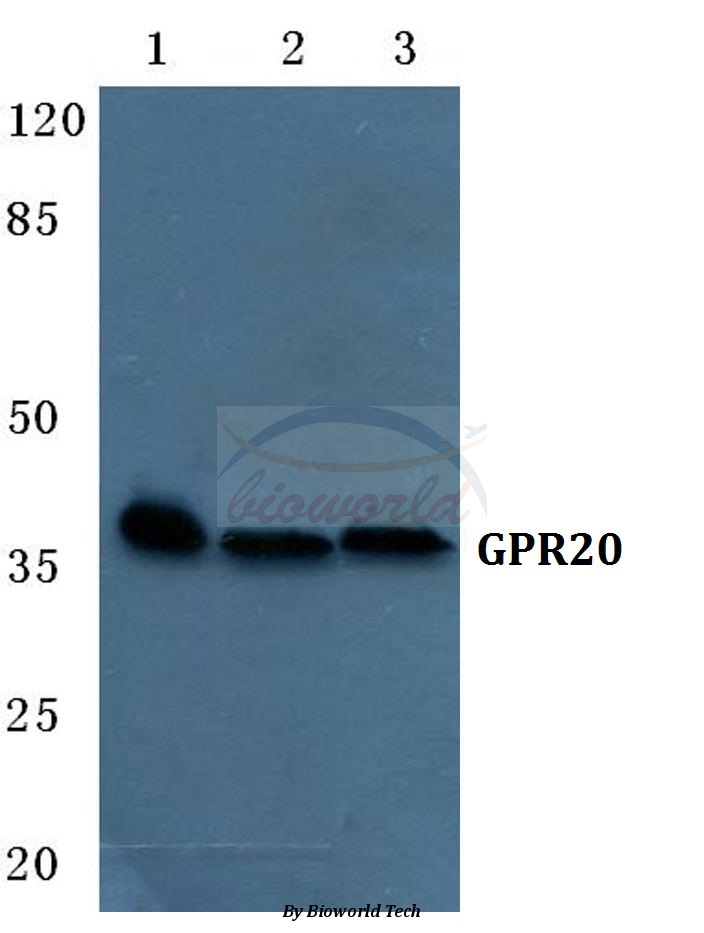 Anti-GPR20 Antibody