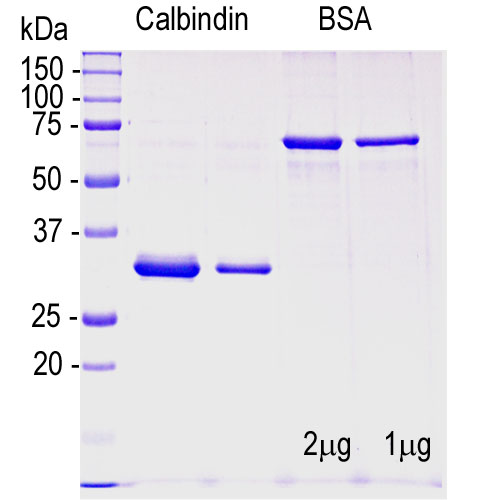 Recombinant Human Calbindin Protein