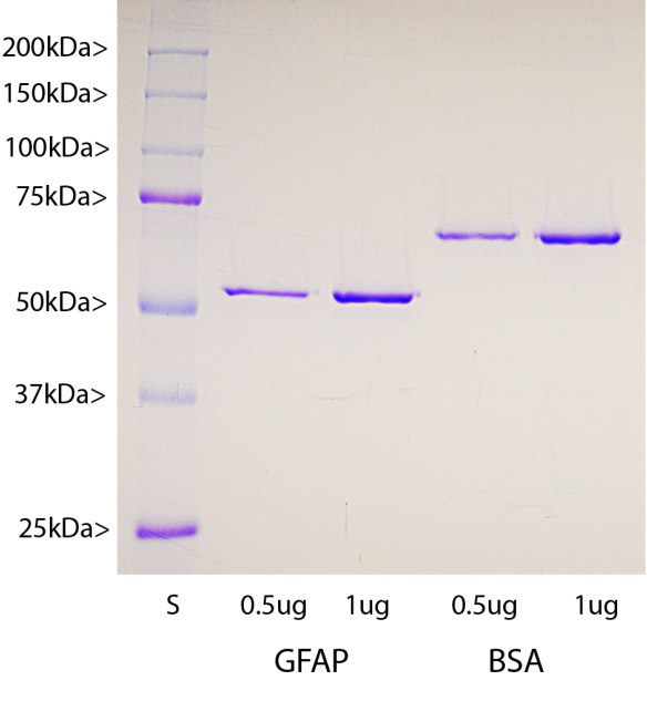 Recombinant Human GFAP Protein