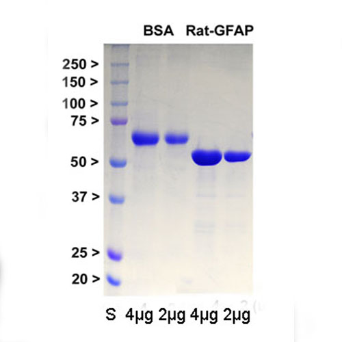 Recombinant Rat GFAP Protein