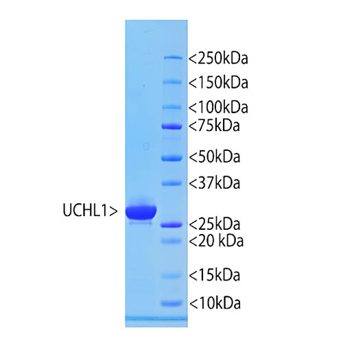 Recombinant Human UCHL1 Protein