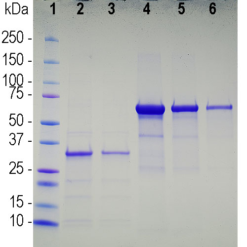 Recombinant SARS-CoV-2 Spike Glycoprotein