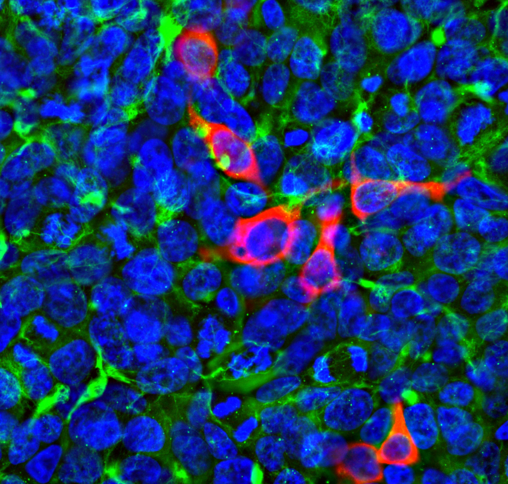 Anti-CRISPR-Cas12j Antibody [5F95]