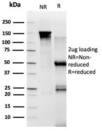 Anti-TADA1 Antibody [PCRP-TADA1-1C9]