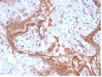 Anti-Fibroblast Activation Protein alpha Antibody [FAP/4851]